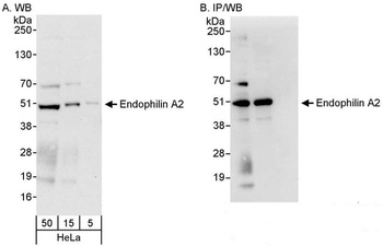 Rabbit Endophilin A2 Antibody