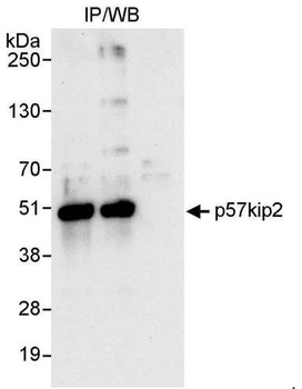 Rabbit p57kip2 Antibody