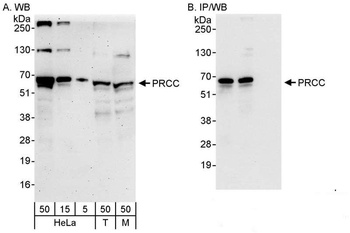 Rabbit PRCC Antibody