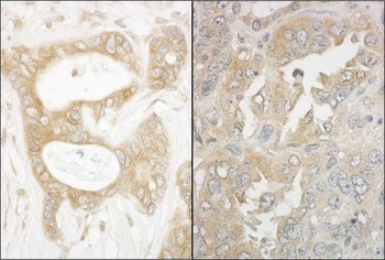 Rabbit anti-EB1 Antibody