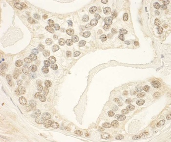 Rabbit anti-PHF23 Antibody