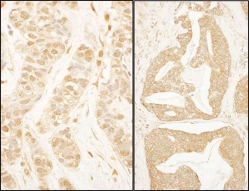 Rabbit anti-BTF3 Antibody