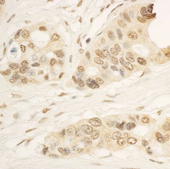 Rabbit anti-RAI1 Antibody