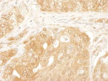 Rabbit YAP1 Antibody
