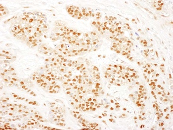 Rabbit anti-RAD23B Antibody