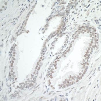 Rabbit anti-BRD7 Antibody