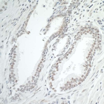 BRD7 Antibody