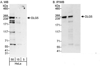 Rabbit anti-DLG5 Antibody