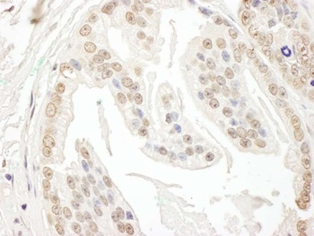 Rabbit anti-POLR3D Antibody