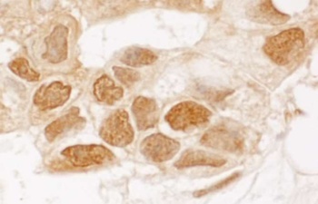 Rabbit anti-TIGAR Antibody