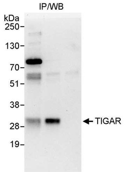 Rabbit anti-TIGAR Antibody