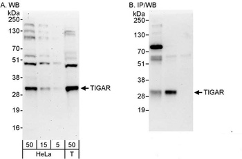 Rabbit anti-TIGAR Antibody