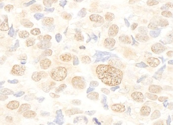 Rabbit FUSIP1 Antibody