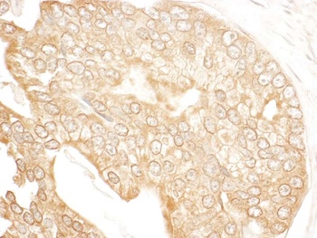 Rabbit anti-p600 Antibody