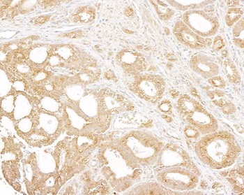 Rabbit anti-p600 Antibody