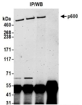 Rabbit anti-p600 Antibody