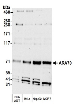 Rabbit ARA70 Antibody
