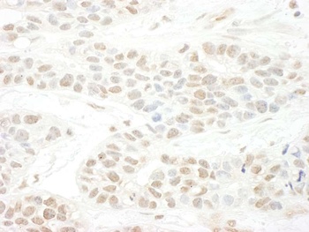 Rabbit anti-BTBD12 Antibody