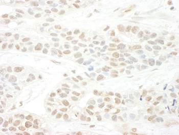 BTBD12 Antibody