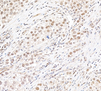 Rabbit anti-MLLT1 Antibody