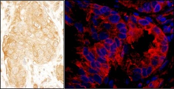 Rabbit anti-SASH1 Antibody