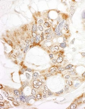 Rabbit anti-DOCK4 Antibody