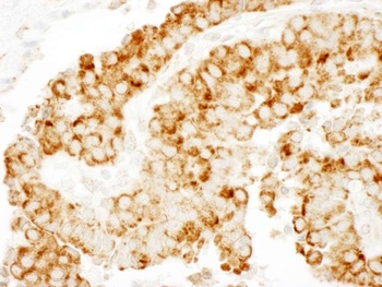 Rabbit anti-CKAP4 Antibody