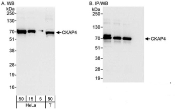 Rabbit anti-CKAP4 Antibody