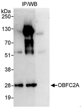 Rabbit OBFC2A Antibody