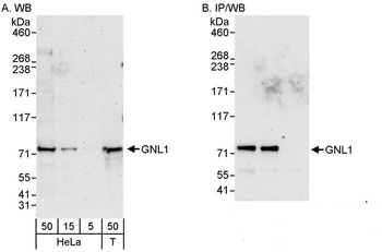 Rabbit GNL1 Antibody