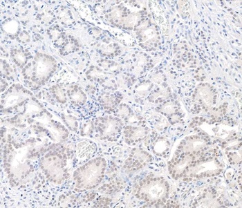 Rabbit anti-BAP1 Antibody