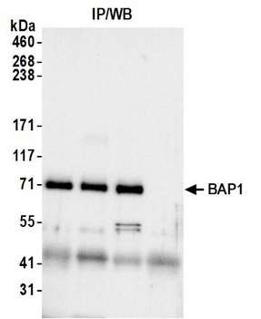 Rabbit anti-BAP1 Antibody