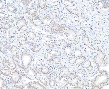 Rabbit anti-BAP1 Antibody