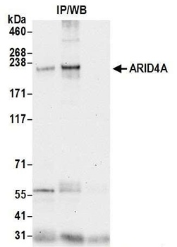 Rabbit anti-ARID4A Antibody