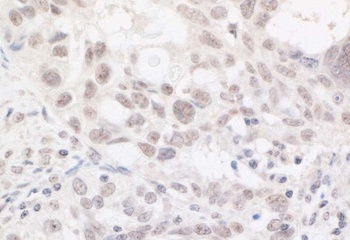 Rabbit anti-ARID2 Antibody