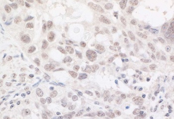 ARID2 Antibody