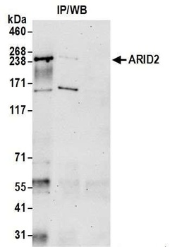 Rabbit anti-ARID2 Antibody