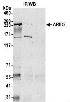 ARID2 Antibody