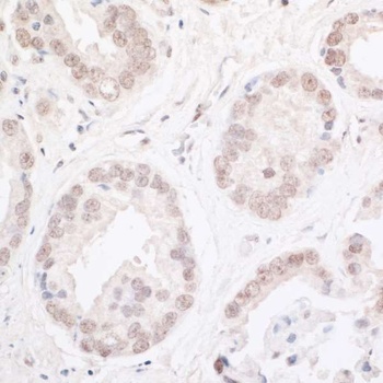Rabbit anti-ARID2 Antibody