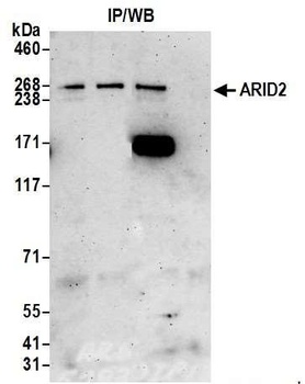 ARID2 Antibody