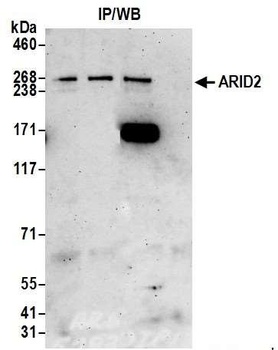 Rabbit anti-ARID2 Antibody