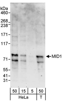 Rabbit MID1 Antibody