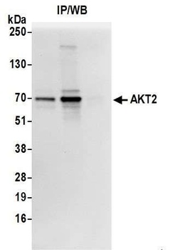 AKT2 Antibody