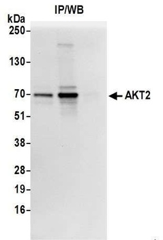 Rabbit anti-AKT2 Antibody