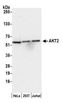 Rabbit anti-AKT2 Antibody