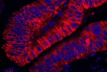 Rabbit anti-ARHGEF5 Antibody