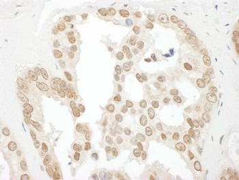 Rabbit anti-BCCIP Antibody