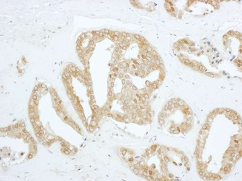 Rabbit anti-PBK Antibody