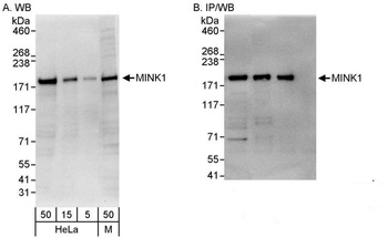 Rabbit MINK1 Antibody
