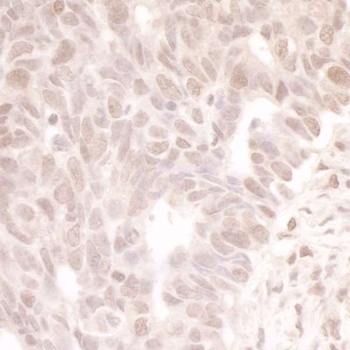 Rabbit anti-MASTL Antibody